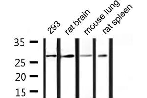 Western blot analysis of extracts from 293, rat brain, mouse lung, rat spleen, using 14-3-3 γ Antibody. (14-3-3 gamma anticorps  (Internal Region))