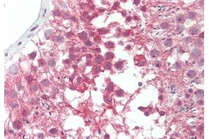 Rabbit Anti-BRD4 antibody  Formalin Fixed Paraffin Embedded Tissue: Human Testis Primary antibody Concentration: 1:100 Secondary Antibody: Donkey anti-Rabbit-Cy3 Secondary Antibody Concentration: 1:200 Magnification: 20x Exposure Time: 0.