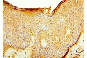 Immunohistochemistry of paraffin-embedded human skin tissue using ABIN7156926 at dilution of 1:100 (IL7R anticorps  (AA 21-239))