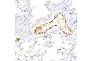 Immunohistochemistry of paraffin-embedded Mouse lung using von Willebrand factor (VWF) antibody (ABIN7271339) at dilution of 1:800 (40x lens). (VWF anticorps)