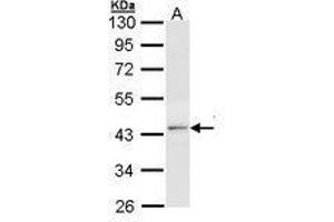Image no. 2 for anti-Thyroid Hormone Receptor, beta (THRB) (AA 1-169) antibody (ABIN467595)