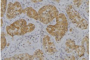 ABIN6273634 at 1/100 staining Human uterus tissue by IHC-P. (HSP77/76 anticorps)
