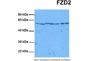 Host:  Rabbit  Target Name:  FZD2  Sample Tissue:  Human HepG2, Human Jurkat, Human MCF7, Human DLD1, Human Hela, Human Fetal Liver, Human Stomach Tumor  Antibody Dilution:  1. (FZD2 anticorps  (N-Term))