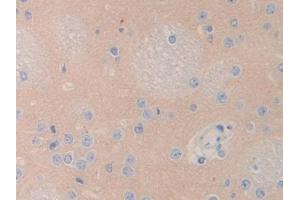 IHC-P analysis of Rat Cerebrum Tissue, with DAB staining. (LCAT anticorps  (AA 290-434))
