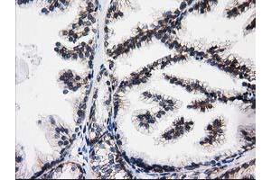 Immunohistochemistry (IHC) image for anti-Aminoacylase 3 (ACY3) antibody (ABIN1496462)