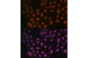 Immunofluorescence analysis of U-2 OS cells using PRMT1 Rabbit mAb  at dilution of 1:100 (40x lens).