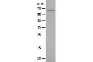 Western Blotting (WB) image for NAD Dependent Malate Dehydrogenase (NAD-ME) (AA 19-584) protein (His tag) (ABIN7124100)
