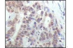 Immunohistochemistry (IHC) image for anti-Ribosomal Protein S6 Kinase, 90kDa, Polypeptide 1 (RPS6KA1) (truncated) antibody (ABIN2464100)