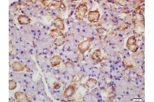 Formalin-fixed and paraffin embedded rat lymph node labeled with Rabbit Anti-Axin 2 Polyclonal Antibody, Unconjugated  at 1:200 followed by conjugation to the secondary antibody and DAB staining (AXIN2 anticorps  (AA 331-430))