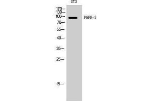 Western Blotting (WB) image for anti-Fibroblast Growth Factor Receptor 3 (FGFR3) (Internal Region) antibody (ABIN3184616) (FGFR3 anticorps  (Internal Region))