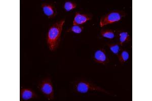 IF analysis of CD168/HMMR using anti-CD168/HMMR antibody (ABIN7601892).