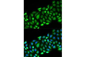 Immunofluorescence analysis of HeLa cell using RIPK2 antibody. (RIPK2 anticorps  (AA 1-540))