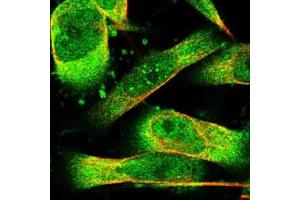 Immunofluorescent staining of U-251 MG with PHPT1 polyclonal antibody  (Green) shows positivity in cytoplasm and nucleus but excluded from the nucleoli.
