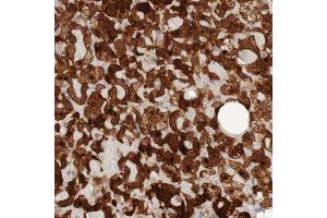 Immunohistochemical staining (Formalin-fixed paraffin-embedded sections) of human adrenal gland with PARP4 polyclonal antibody  shows strong nuclear and cytoplasmic positivity in cortical cells. (PARP4 anticorps  (AA 247-392))