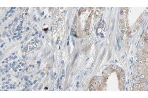 ABIN6272944 at 1/100 staining Human prostate tissue by IHC-P. (HMGCS1 anticorps  (Internal Region))