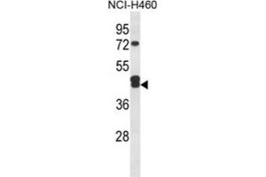 Western Blotting (WB) image for anti-Isocitrate Dehydrogenase 3 (NAD+) gamma (IDH3G) antibody (ABIN3004326) (IDH3G anticorps)