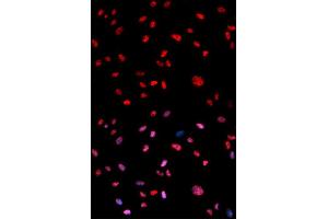 Immunofluorescence analysis of U2OS cells using Phospho-Jun-T239 antibody (ABIN5969906). (C-JUN anticorps  (pThr239))