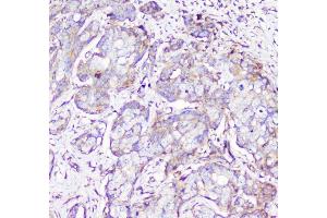 IHC analysis of RP2 using anti-RP2 antibody (ABIN6719513).