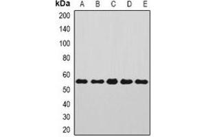 Western blot analysis of Annexin A11 expression in Jurkat (A), SKOV3 (B), A549 (C), mouse kidney (D), rat brain (E) whole cell lysates.