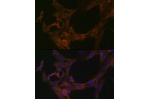 Immunofluorescence analysis of NIH-3T3 cells using STK39 Rabbit mAb (ABIN1682890, ABIN3015922, ABIN3015923 and ABIN7101461) at dilution of 1:100 (40x lens).