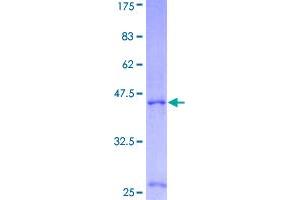 Image no. 1 for Interleukin 4 (IL4) (AA 1-153) protein (GST tag) (ABIN1307825)