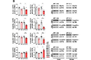 Expression analyses of Ca2+ associated subcellular signaling pathways in Atxn2-CAG100-KIN cerebellum throughout disease course.