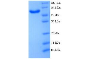 SDS-PAGE (SDS) image for Microtubule Associated Monoxygenase, Calponin and LIM Domain Containing 2 (MICAL2) (AA 1-495), (partial) protein (His tag) (ABIN5713642)