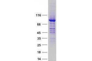 Validation with Western Blot (ALDH16A1 Protein (Transcript Variant 1) (Myc-DYKDDDDK Tag))