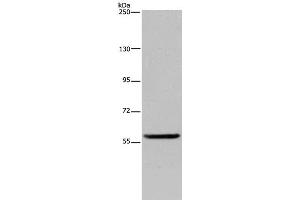 Western Blot analysis of Human fetal brain tissue using LBR Polyclonal Antibody at dilution of 1:300 (Lamin B Receptor anticorps)