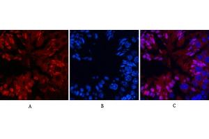 Immunofluorescence analysis of mouse testis tissue. (NF-kB p65 anticorps  (acLys310))