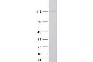 Validation with Western Blot