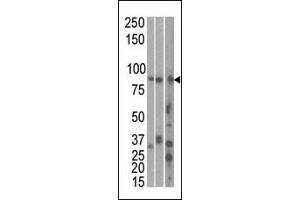 The anti-RK1 C-term Pab 7144b is used in Western blot to detect RK1 in, from left to right, Hela, T47D, and mouse brain cell line/ tissue lysate. (MARK1 anticorps  (C-Term))