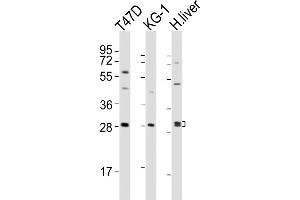All lanes : Anti-HAVCR2 Antibody (Center) at 1:2000 dilution Lane 1: T47D whole cell lysates Lane 2: KG-1 whole cell lysates Lane 3: human liver lysates Lysates/proteins at 20 μg per lane. (TIM3 anticorps  (AA 167-194))