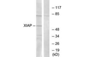 Western blot analysis of extracts from 293 cells, using XIAP (Ab-87) Antibody. (Intestinal Alkaline Phosphatase anticorps  (AA 53-102))