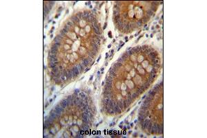 TRIM38 Antibody (C-term) (ABIN657328 and ABIN2846398) immunohistochemistry analysis in formalin fixed and paraffin embedded human colon tissue followed by peroxidase conjugation of the secondary antibody and DAB staining. (TRIM38 anticorps  (C-Term))