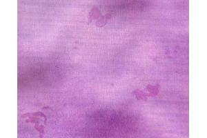 Immunohistochemistry (IHC) image for Osteoclast (Rat) Culture Kit (ABIN956046) (Osteoclast (Rat) Culture Kit)