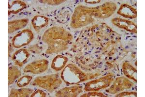 IHC image of ABIN7151580 diluted at 1:400 and staining in paraffin-embedded human kidney tissue performed on a Leica BondTM system. (ELP3/KAT9 anticorps  (AA 1-85))