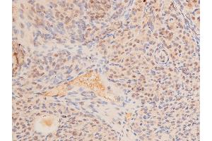 ABIN6267066 at 1/200 staining rat ovarian tissue sections by IHC-P.