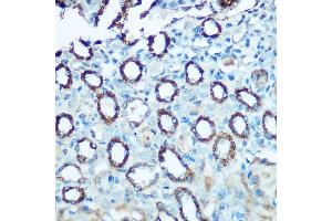Immunohistochemistry of paraffin-embedded rat kidney using NDUFS4 Rabbit pAb (ABIN6132405, ABIN6144489, ABIN6144491 and ABIN6222016) at dilution of 1:100 (40x lens). (NDUFS4 anticorps  (AA 1-175))