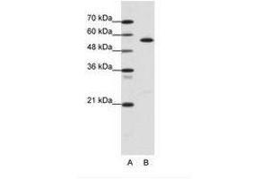 Image no. 1 for anti-Coronin, Actin Binding Protein, 1A (CORO1A) (AA 181-230) antibody (ABIN6736110) (Coronin 1a anticorps  (AA 181-230))