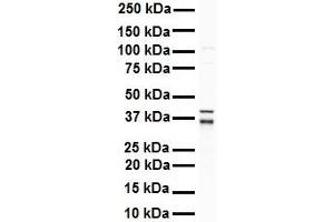 WB Suggested Anti-GAPDH antibody Titration: 1 ug/mL Sample Type: Human Raji (GAPDH anticorps  (Middle Region))