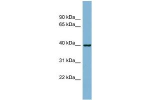 WB Suggested Anti-ELMOD2 Antibody Titration: 0. (ELMOD2 anticorps  (N-Term))