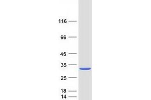 Validation with Western Blot