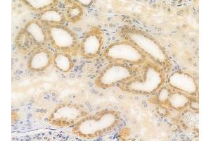 ABIN6256891 and ABIN6274295 at 1/100 staining human normal kidney tissue by IHC-P. (ADK anticorps  (N-Term))