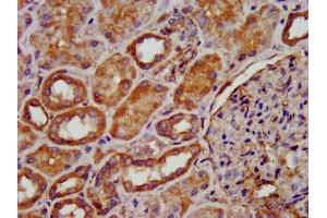 IHC image of ABIN7149571 diluted at 1:200 and staining in paraffin-embedded human kidney tissue performed on a Leica BondTM system. (PDSS2 anticorps  (AA 292-387))