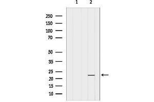 anti-Oligonucleotide/oligosaccharide-Binding Fold Containing 2A (OBFC2A) (Internal Region) antibody