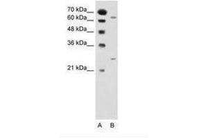 Image no. 1 for anti-N-Acetyltransferase 2 (Arylamine N-Acetyltransferase) (NAT2) (AA 151-200) antibody (ABIN205032) (NAT2 anticorps  (AA 151-200))