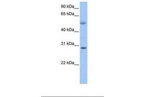 Image no. 1 for anti-Retinoic Acid Induced 12 (RAI12) (C-Term) antibody (ABIN6738920)