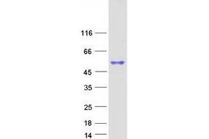 Validation with Western Blot