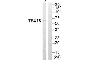 Western Blotting (WB) image for anti-T-Box 18 (TBX18) (Internal Region) antibody (ABIN1852256) (T-Box 18 anticorps  (Internal Region))